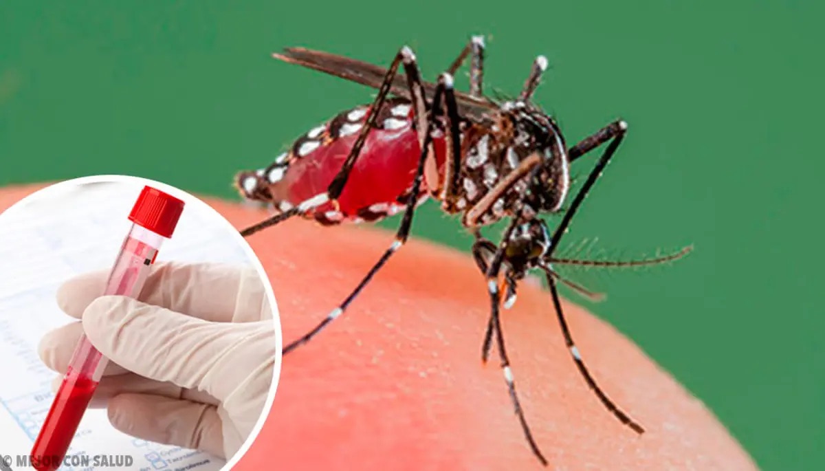 RD reduce más de 85 % los casos de dengue en comparación con 2024, según Salud Pública