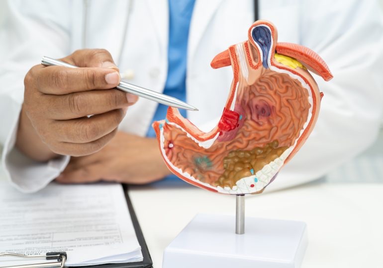 Prevenir el cáncer de páncreas es posible con hábitos saludables 4 img 4449