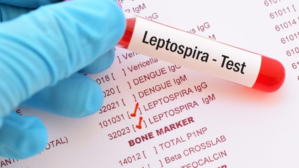 República Dominicana reporta 11 nuevos casos de leptospirosis tras paso de la tormenta Melissa 1 img 7075