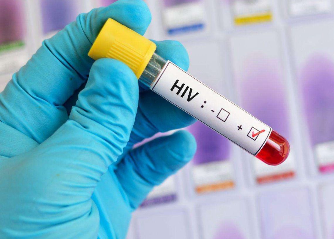 Muchos portadores de VIH no saben que tienen el virus