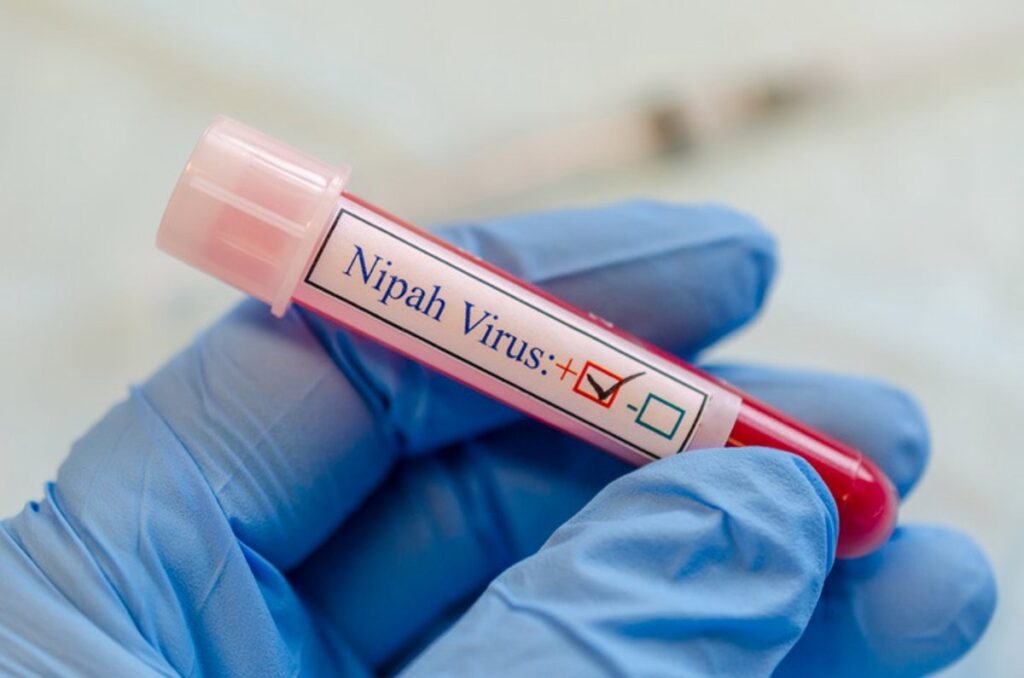 Salud Pública afirma que refuerza protocolos ante virus emergentes como el Nipah 1 img 4132