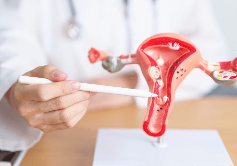 Experto: La mayoría de pacientes de de cáncer de ovario en RD, 55%, son diagnosticadas en etapas avanzadas