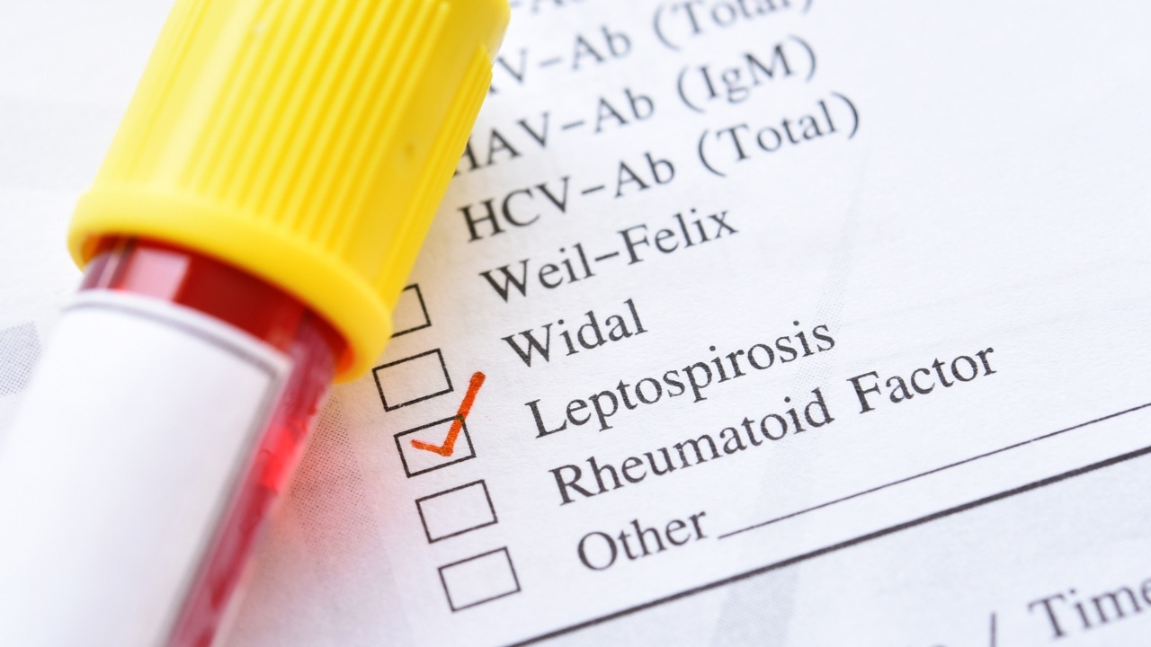 Salud Pública reporta aumento de leptospirosis en el país; casos ascienden a 74