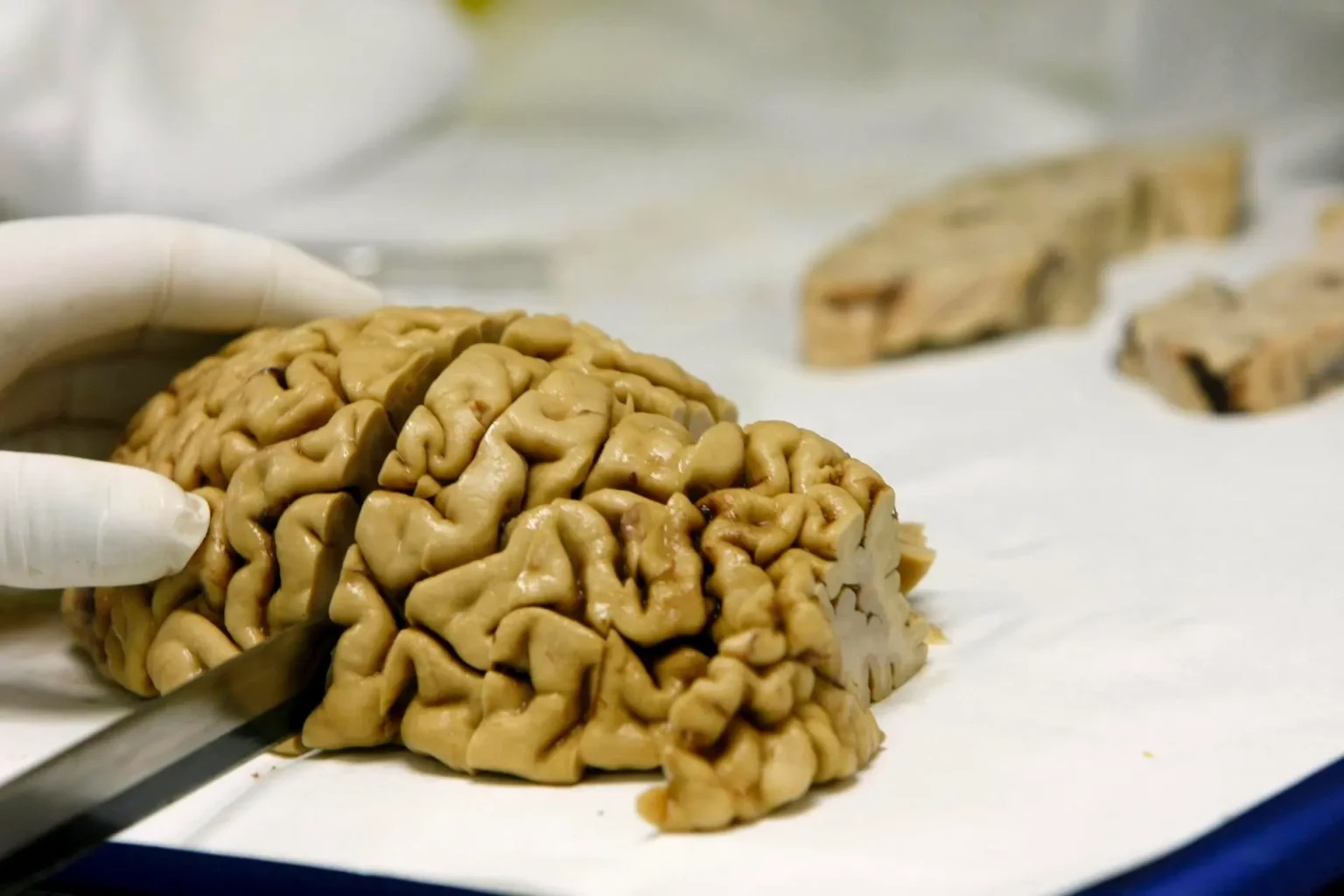 Todas las cosas buenas que las vacaciones hacen en el cerebro (y si no las tienes, sigue estos consejos)