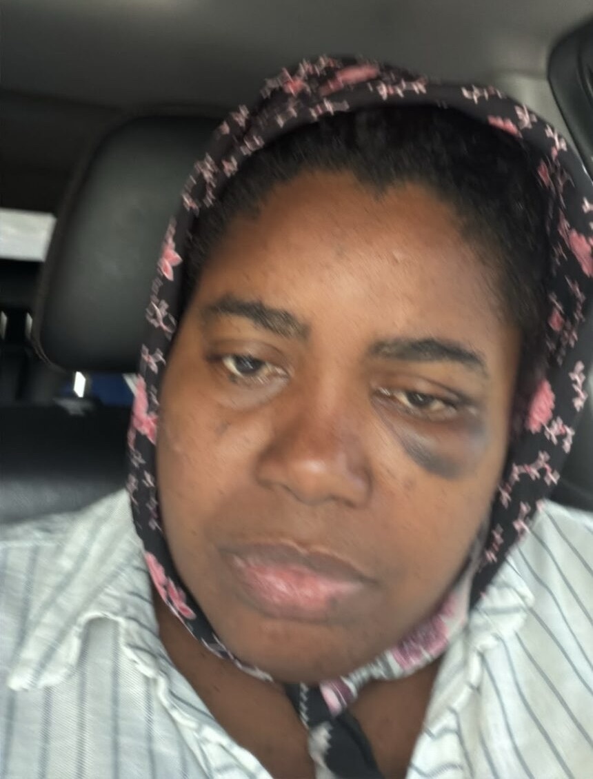 Maestra denuncia que ella, su esposo y su hijo de 15 años fueron agredidos a batazos por una pareja en Higüey
