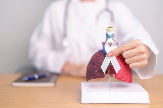 Cáncer de Pulmón: los avances que permiten controlar y superar la enfermedad