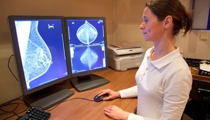 Atención multidisciplinaria como modelo para el diagnóstico temprano del cáncer